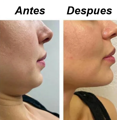 Reafirma tu ROSTRO en SEGUNDOS - Nireva tiras lifting invisibles