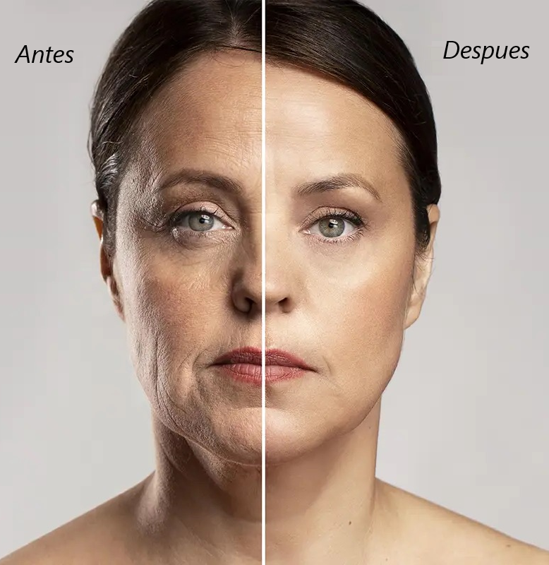 Reafirma tu ROSTRO en SEGUNDOS - Nireva tiras lifting invisibles