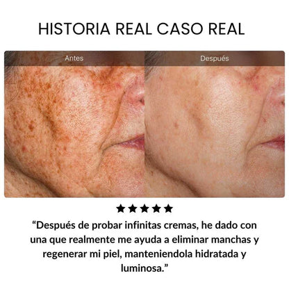 Rejuvenece +10 Años Retinol Dragon Blood